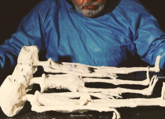 Unknown Metal Implants Found in the Nazca Mummies